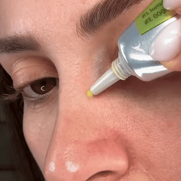 Booster de raffermissement rétinien par injection. La formule de qualité clinique qui fonctionne – Cheoni